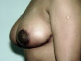 Patient # 78241 After Photo # 2