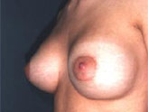 Patient # 39607 After Photo # 2