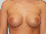 Patient # 28711 After Photo # 2
