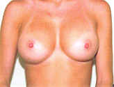 Patient # 15204 After Photo # 2