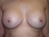 Patient # 31579 After Photo # 2