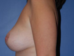 Patient # 67863 After Photo # 6