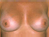 Patient # 41602 After Photo # 2