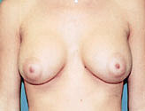 Patient # 48259 After Photo # 2