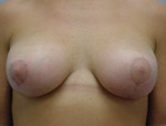 Patient # 54937 After Photo # 2