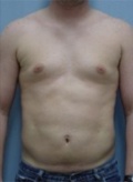 Patient # 15016 After Photo # 2