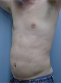 Patient # 15016 After Photo # 4