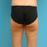 Patient # 16533 After Photo # 2