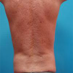 Patient # 42659 After Photo # 2