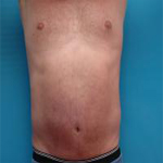 Patient # 42659 After Photo # 4