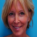 Patient # 74822 After Photo # 2