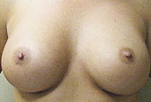 Patient # 51596 After Photo # 2
