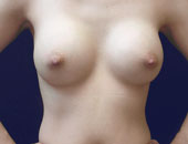 Patient # 16485 After Photo # 2