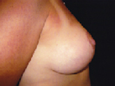 Patient # 59112 After Photo # 2