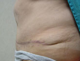 Patient # 18668 After Photo # 4