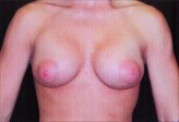Patient # 58265 After Photo # 2