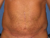 Patient # 43140 After Photo # 2