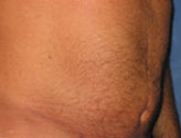 Patient # 43140 After Photo # 4