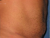 Patient # 43140 After Photo # 6