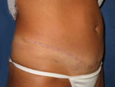Patient # 35030 After Photo # 4