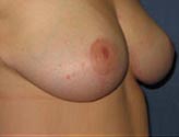 Patient # 45653 After Photo # 4