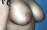 Patient # 13310 After Photo # 2