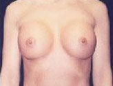 Patient # 89160 After Photo # 2
