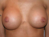 Patient # 67845 After Photo # 2