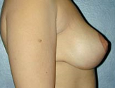 Patient # 65273 After Photo # 4