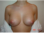 Patient # 41813 After Photo # 2