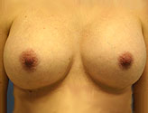 Patient # 89679 After Photo # 2