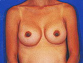 Patient # 88453 After Photo # 2