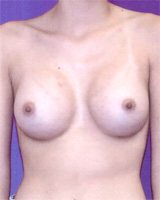 Patient # 11322 After Photo # 2