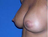 Patient # 10143 After Photo # 6