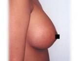 Patient # 39176 After Photo # 2