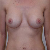 Patient # 73035 After Photo # 2