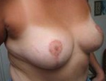 Patient # 39690 After Photo # 4