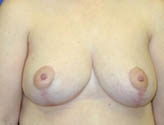Patient # 74636 After Photo # 2