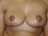 Patient # 34719 After Photo # 2