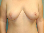 Patient # 96608 After Photo # 2