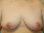 Patient # 73937 After Photo # 2