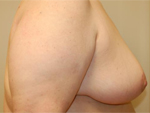 Patient # 73937 After Photo # 4