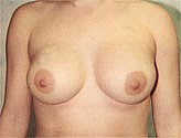 Patient # 17237 After Photo # 2