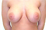 Patient # 50919 After Photo # 2