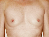 Patient # 35517 Before Photo # 1