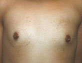 Patient # 12105 Before Photo # 1