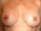 Patient # 45499 After Photo # 2
