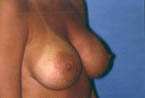 Patient # 24306 After Photo # 2