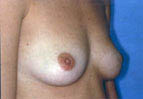 Patient # 67937 Before Photo # 1