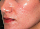 Patient # 85399 After Photo # 2